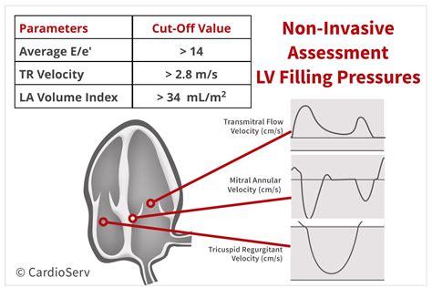 raised lv filling pressures